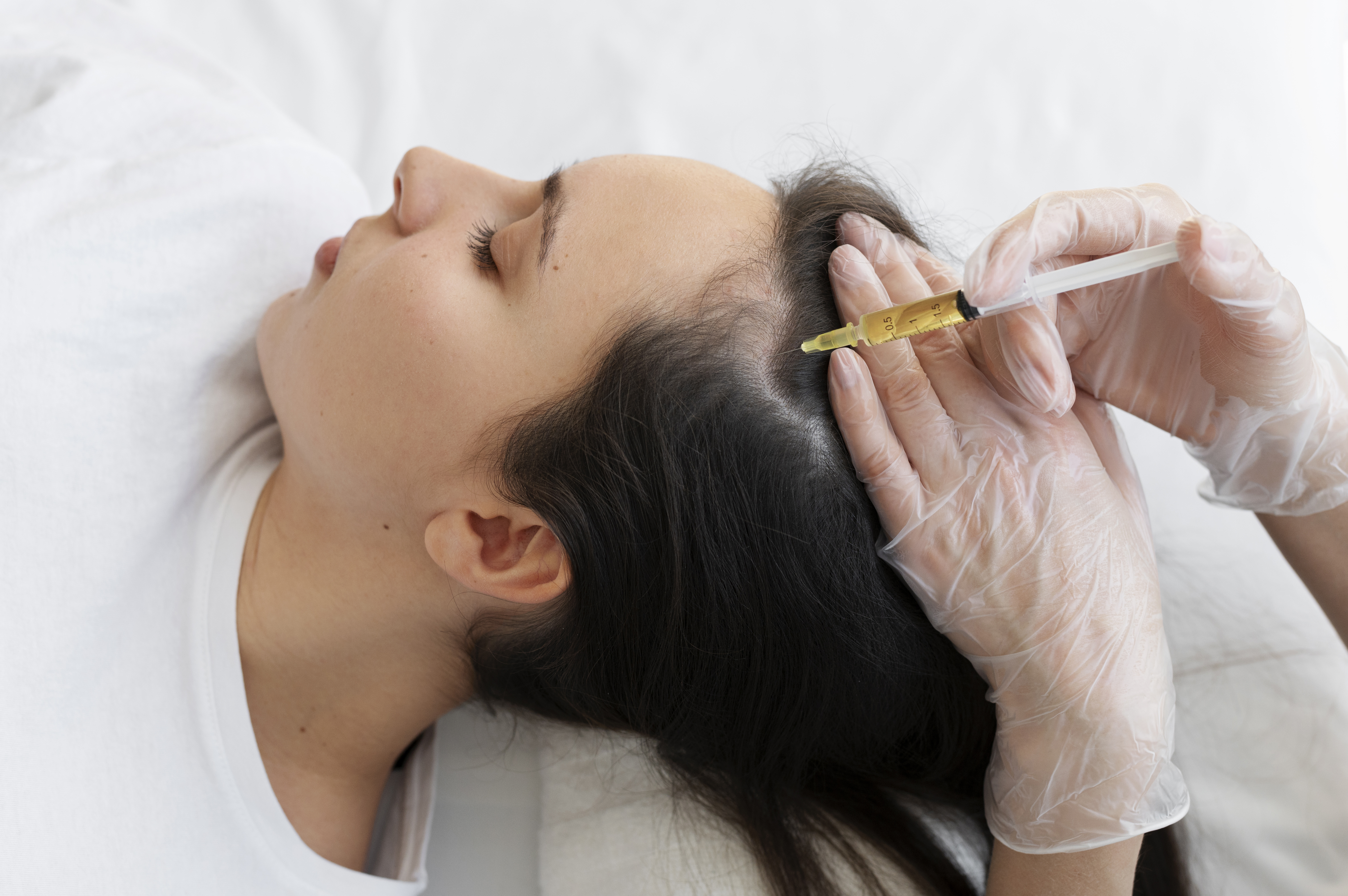 PRP treatment for hair growth at Apollo Clinic Coimbatore